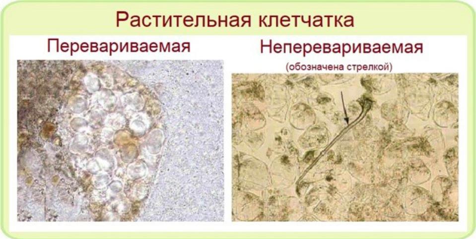 Растительная клетчатка в кале что значит. Микроскопия кала переваримая клетчатка. Микроскопия кала растительная клетчатка непереваримая. Растительная клетчатка переваримая в Кале. Копрология кала микроскопия.