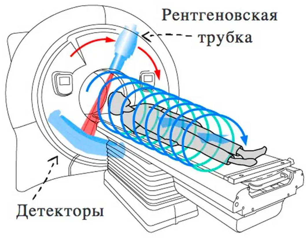 Кт без кожуха. Спиральная компьютерная томография (СКТ).. Спиральная и Мультиспиральная компьютерная томография отличия. Схема рентгеновского компьютерного томографа. Кт спиральная и Мультиспиральная.