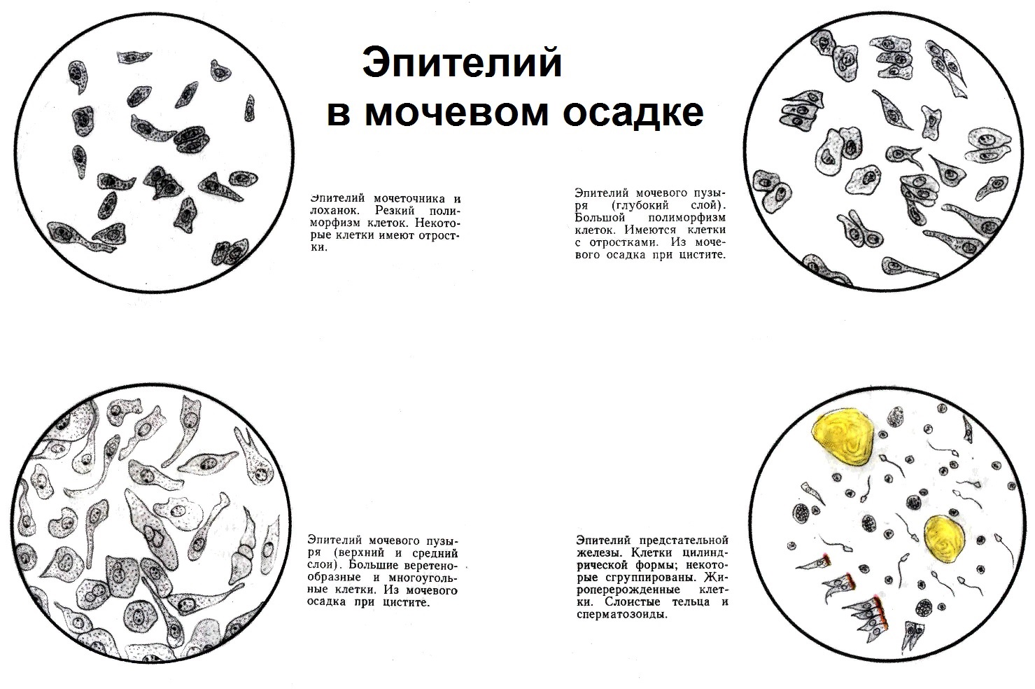 Общий анализ мочи – норма у взрослого и ребенка, расшифровка результатов ОАМ